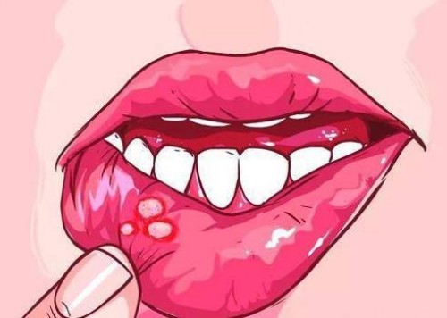哺乳期奶水少怎么办-这些方法能够有效化解你的烦恼