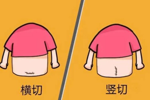 子宫肌瘤做微创有哪些好处？
